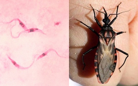 La enfermedad de Chagas y su incidencia en España